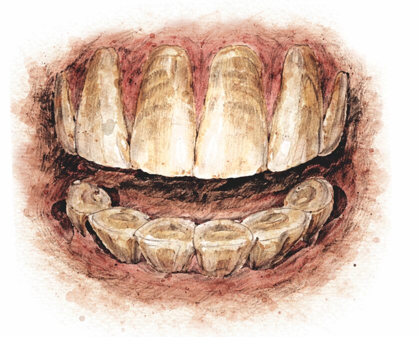 Occlusal table structures